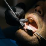 Professional-Teeth-Cleaning